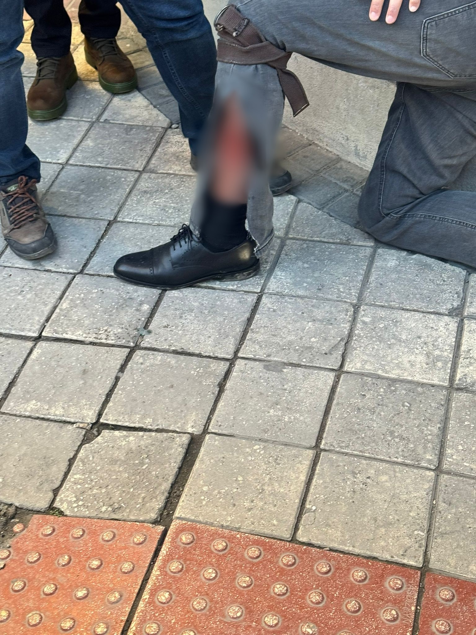 Aydın’da Bir Kişi Bacağından Vuruldu (2)